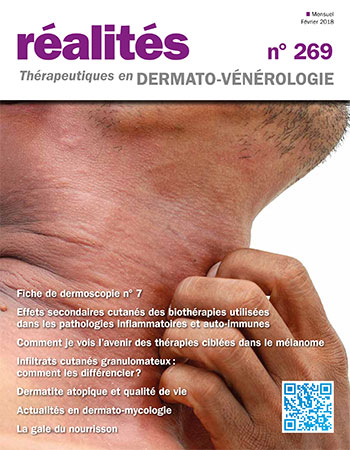 REALITES THERAPEUTIQUES EN DERMATO VENEROLOGIE