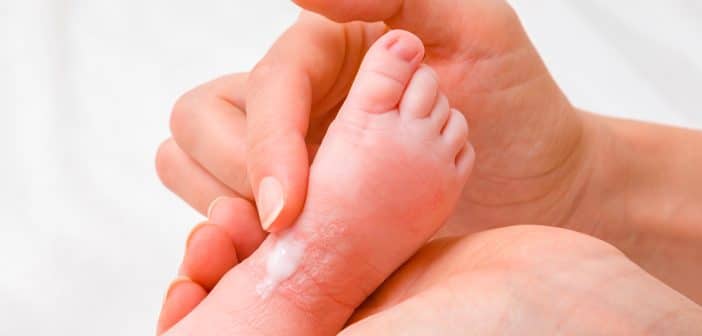 Quoi de neuf en dermatologie pédiatrique ?
