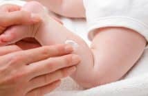 Urticaire de l’enfant