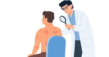 Psoriasis : quel parcours en ville ?