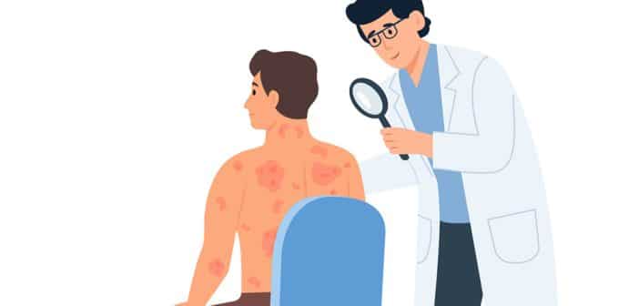 Psoriasis : quel parcours en ville ?