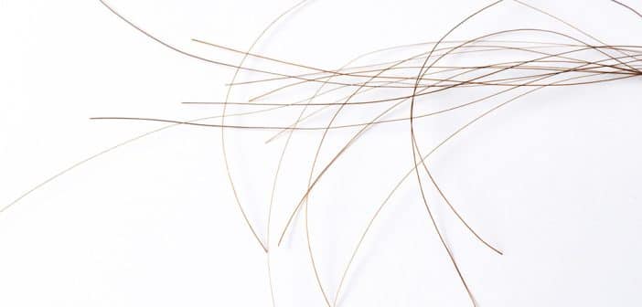 Pelade : cibler la voie JAK-STAT