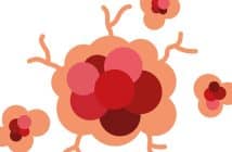 Cancers cutanés et maladies inflammatoires