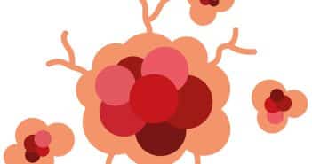 Cancers cutanés et maladies inflammatoires