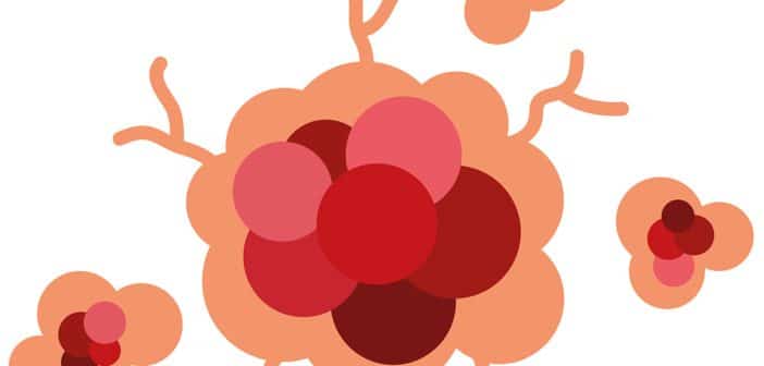 Cancers cutanés et maladies inflammatoires